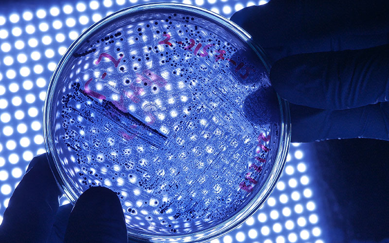 Petri dish with Legionnaires disease