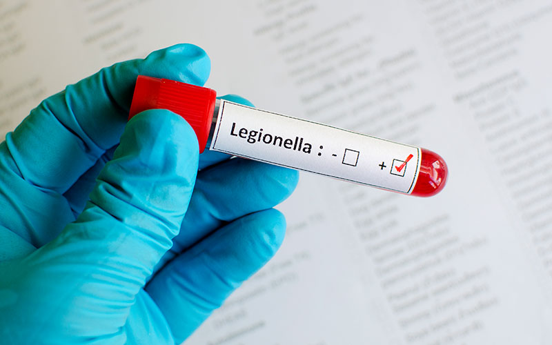 Legionella test tube result positive